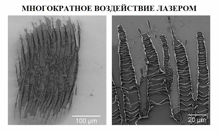 Многократное воздействие лазером Многократное воздействие лазером